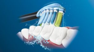 Philips Sonicare's advanced sonic technology